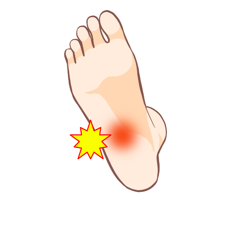 朝起きたときの一歩目や、座っていて立とうとしたときの一歩目に足裏が痛む。これは足底筋膜炎？