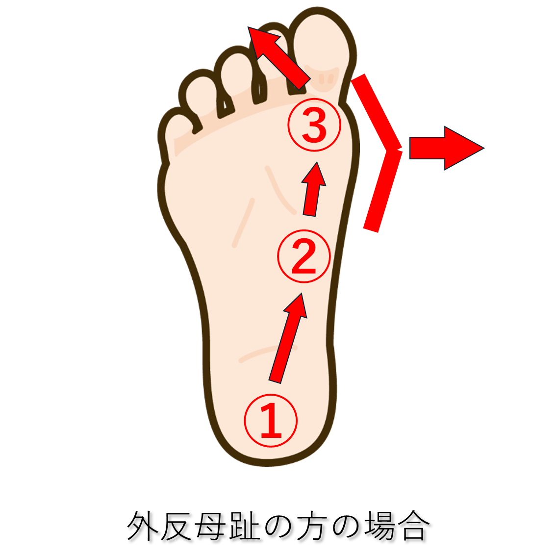 外反母趾になる歩き方、重心移動