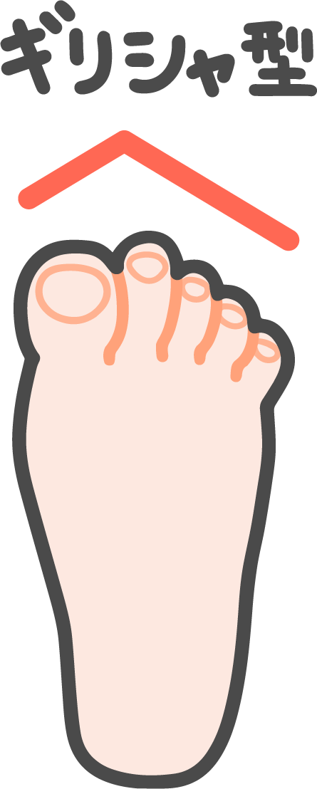 ギリシャ型の足